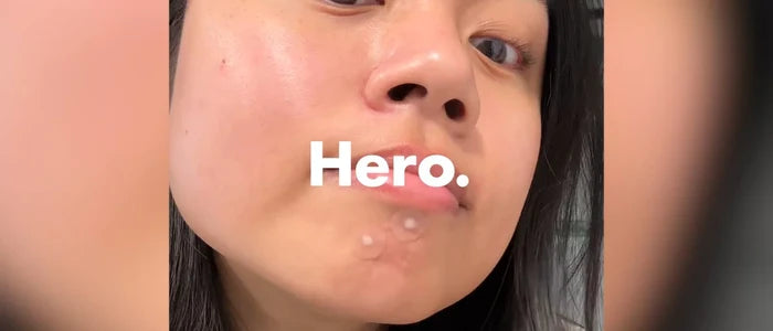 Hero Cosmetics 2 Pack/72ct Each Cosmetics Mighty Patch Original Acne Pimple Patches