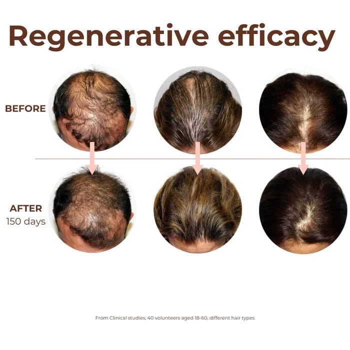 Peptide Miracle Hair Growth Serum